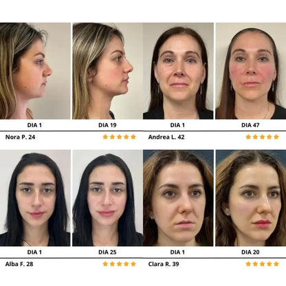 ✨ LuminSkin™ – Di adiós a arrugas y flacidez en solo 15 min ✨